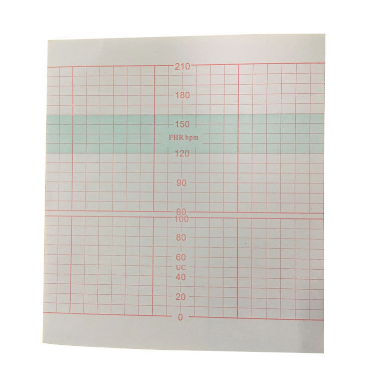 Sanrui 618B Thermal Recording Paper 112*100-150P C03 Fetal Monitor Heart Rate Medical Consumables CE Certified Class I White 3